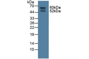 Detection of NOSTRIN in Rat Lung Tissue using Polyclonal Antibody to Nitric Oxide Synthase Trafficker (NOSTRIN)