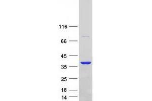 Validation with Western Blot
