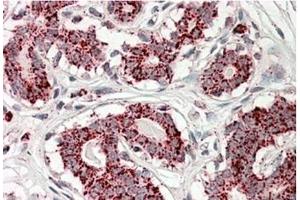 AP23725PU-N ACO2 Antibody staining of paraffin embedded Human Breast at 3. (ACO2 anticorps  (Internal Region))