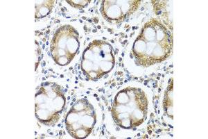 Immunohistochemistry of paraffin-embedded human colon using IFI44 antibody at dilution of 1:100 (40x lens). (IFI44 anticorps)