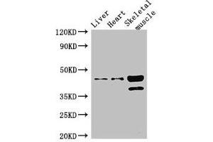 Western Blot Positive WB detected in: Mouse liver tissue, Mouse heart tissue, Mouse skeletal muscle tissue All lanes: ACAD8 antibody at 3 μg/mL Secondary Goat polyclonal to rabbit IgG at 1/50000 dilution Predicted band size: 46, 32, 39 kDa Observed band size: 46, 39 kDa (Acad8 anticorps  (AA 201-415))
