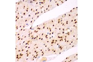 Immunohistochemistry of paraffin-embedded human colon using TEAD3 antibody (ABIN5975292) at dilution of 1/100 (40x lens). (TEAD3 anticorps)