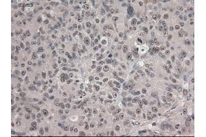 Immunohistochemical staining of paraffin-embedded colon using anti-Notch1 (ABIN2452671) mouse monoclonal antibody. (Notch1 anticorps  (AA 2300-2556))