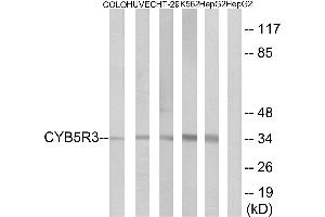 Immunohistochemistry analysis of paraffin-embedded human placenta tissue using CYB5R3 antibody. (CYB5R3 anticorps  (Internal Region))