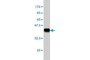 Western Blot detection against Immunogen (38. (ILK anticorps  (AA 341-452))