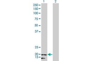 Western Blot analysis of NDUFB5 expression in transfected 293T cell line by NDUFB5 monoclonal antibody (M01), clone 5G5. (NDUFB5 anticorps  (AA 95-189))