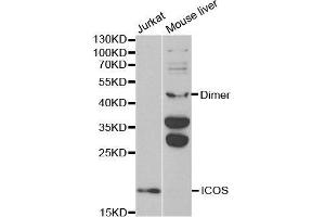 Western blot analysis of extracts of various cell lines, using ICOS antibody. (ICOS anticorps  (AA 21-140))