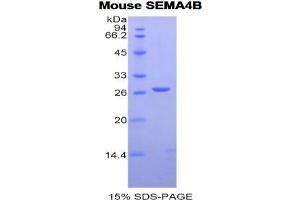 SDS-PAGE analysis of Mouse Semaphorin 4B Protein. (SEMA4B Protéine)