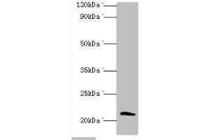 Western blot All lanes: Protein SSX2 antibody at 2 μg/mL + MDA-MB-231 whole cell lysate Secondary Goat polyclonal to rabbit IgG at 1/10000 dilution Predicted band size: 22, 26 kDa Observed band size: 22 kDa (SSX2 anticorps  (AA 1-188))