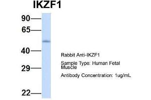 Host:  Rabbit  Target Name:  IKZF1  Sample Type:  Human Fetal Muscle  Antibody Dilution:  1. (IKZF1 anticorps  (Middle Region))