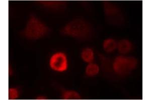 Image no. 1 for anti-Synuclein, alpha (SNCA) (Tyr136) antibody (ABIN319339) (SNCA anticorps  (Tyr136))