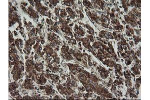 Image no. 3 for anti-Trafficking Protein Particle Complex 4 (TRAPPC4) antibody (ABIN1501265)