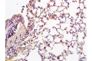 Formalin-fixed and paraffin embedded mouse lung labeled with Anti-CD28 Polyclonal Antibody, Unconjugated (ABIN674604) at 1:200 followed by conjugation to the secondary antibody and DAB staining