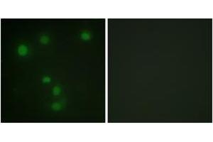 Immunofluorescence analysis of HuvEc cells, using Retinoblastoma (Ab-826) Antibody. (Retinoblastoma Protein (Rb) anticorps  (AA 601-650))