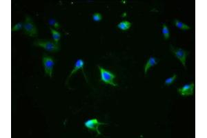 Immunofluorescence staining of SH-SY5Y cells with ABIN7127710 at 1:100,counter-stained with DAPI. (Recombinant MAPT anticorps  (pSer324))