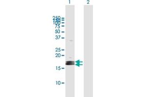 Western Blot analysis of LOC124220 expression in transfected 293T cell line by LOC124220 MaxPab polyclonal antibody. (ZG16B anticorps  (AA 1-172))