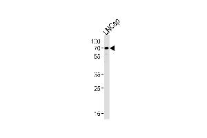 Western blot analysis of lysate from LNCap cell line, using CYP51A1 Antibody (Center) (ABIN652820 and ABIN2842535). (CYP51A1 anticorps  (AA 250-279))