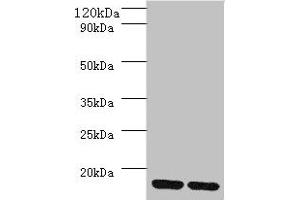 Western blot All lanes: MRPL55 antibody at 2 μg/mL Lane 1: K562 whole cell lysaye Lane 2: PC-3 whole cell lysaye Secondary Goat polyclonal to rabbit IgG at 1/10000 dilution Predicted band size: 16, 19 kDa Observed band size: 16 kDa (MRPL55 anticorps  (AA 34-128))