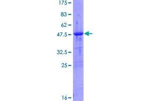 Image no. 1 for Deoxythymidylate Kinase (Thymidylate Kinase) (DTYMK) (AA 1-212) protein (GST tag) (ABIN1352073)