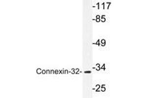 Western blot analysis of Connexin-32 antibody in extracts from LOVO cells.