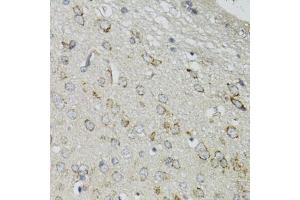 Immunohistochemistry of paraffin-embedded mouse brain using DGUOK antibody (ABIN5975065) at dilution of 1/100 (40x lens).