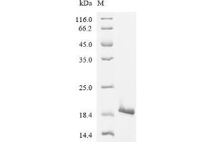 (Tris-Glycine gel) Discontinuous SDS-PAGE (reduced) with 5 % enrichment gel and 15 % separation gel.