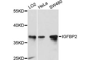 Western blot analysis of extracts of various cell lines, using IGFBP2 antibody. (IGFBP2 anticorps)
