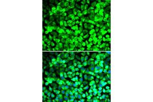 Immunofluorescence analysis of U2OS cells using EIF5 antibody.
