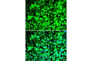 Immunofluorescence analysis of U2OS cells using EIF5 antibody. (EIF5 anticorps  (AA 1-235))