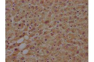 IHC image of ABIN7160070 diluted at 1:100 and staining in paraffin-embedded human liver tissue performed on a Leica BondTM system.