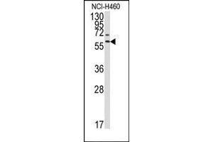 anti-Matrix Metallopeptidase 17 (Membrane-inserted) (MMP17) (Middle Region) antibody