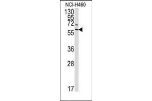 Image no. 1 for anti-Matrix Metallopeptidase 17 (Membrane-inserted) (MMP17) (Middle Region) antibody (ABIN358690) (MMP17 anticorps  (Middle Region))