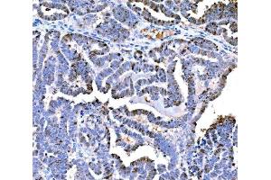 IHC analysis of DPY19L1 using anti-DPY19L1 antibody (ABIN7601445).