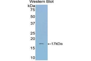 Western Blotting (WB) image for anti-Ribonuclease, RNase A Family, 1 (Pancreatic) (RNASE1) (AA 31-150) antibody (ABIN1172716) (RNASE1 anticorps  (AA 31-150))