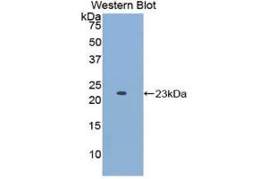 Detection of Recombinant APOE, Human using Polyclonal Antibody to Apolipoprotein E (APOE)