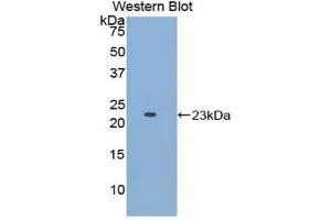 Detection of Recombinant APOE, Human using Polyclonal Antibody to Apolipoprotein E (APOE) (APOE anticorps  (AA 19-181))