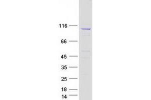 Validation with Western Blot