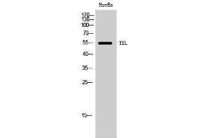 Western Blotting (WB) image for anti-Ets Variant 6 (ETV6) (Ser37) antibody (ABIN3177671) (ETV6 anticorps  (Ser37))