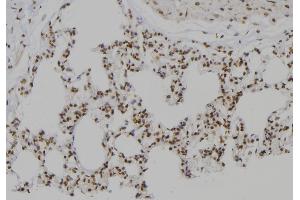 ABIN6276999 at 1/100 staining Rat lung tissue by IHC-P. (PSMC2 anticorps  (Internal Region))