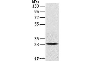 Western blot analysis of Mouse brain tissue, using TREM2 Polyclonal Antibody at dilution of 1:250 (TREM2 anticorps)