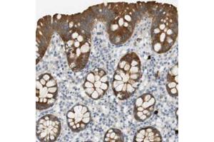 Immunohistochemical staining (Formalin-fixed paraffin-embedded sections) of human colon with PDE3A polyclonal antibody  shows strong cytoplasmic positivity in glandular cells.