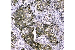 IHC analysis of MYBPC3 using anti-MYBPC3 antibody .