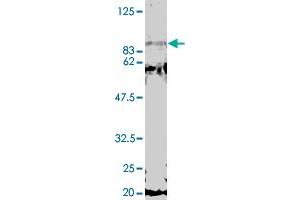 Detection of GCN5 by Western blotting using the GCN5 polyclonal antibody  .