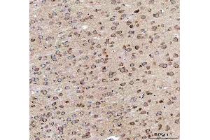 IHC analysis of EEA1 using anti-EEA1 antibody (ABIN5692856). (EEA1 anticorps)