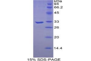 SDS-PAGE analysis of Human Myosin Heavy Chain 16 Protein. (MYH16 Protéine)