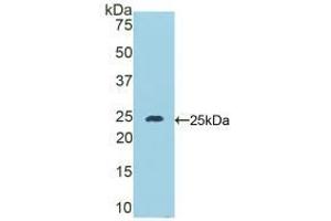 Western blot analysis of recombinant Mouse DSC1. (Desmocollin 1 anticorps  (AA 135-340))