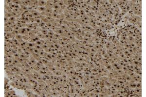 ABIN6273166 at 1/100 staining Mouse liver tissue by IHC-P.