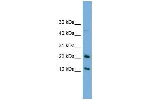 GM2A antibody used at 1 ug/ml to detect target protein. (GM2A anticorps  (N-Term))