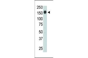 Antibody is used in Western blot to detect CD45 in jurkat cell lysate.