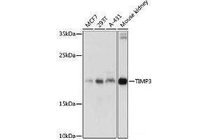 Western blot analysis of extracts of various cell lines using TIMP3 Polyclonal Antibody at dilution of 1:1000. (TIMP3 anticorps)